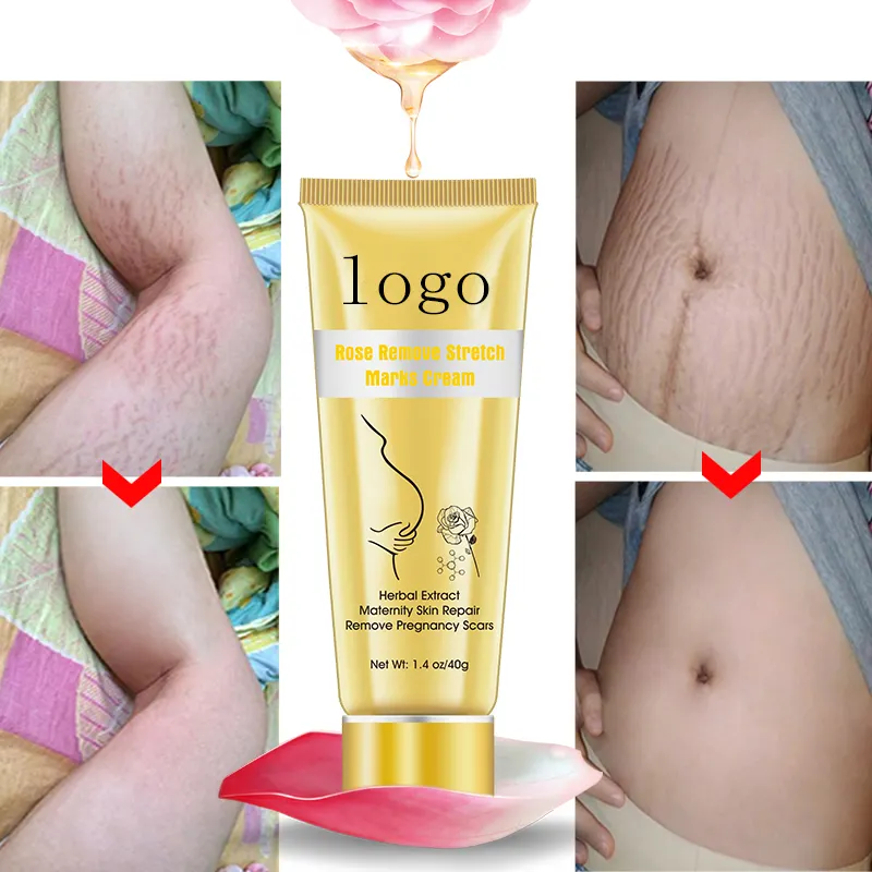 Wholesale Customize OEM stretch marks removal cream natural rose best effective repairing pregnant belly mark cream 1001