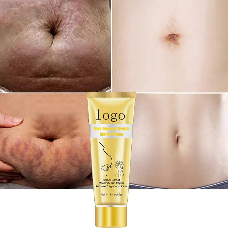 Wholesale Customize OEM stretch marks removal cream natural rose best effective repairing pregnant belly mark cream 1001