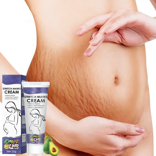 Wholesale Postpartum Stretch Mark Cream OEM Abdomen Thighs Leg Buttocks Chest Pregnancy Stretch Mark Removal Cream For Female 1002