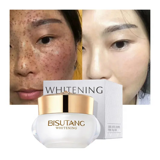 Pimples Melasma Blemish Removal Dark Spot Remover Cream Strong Bleaching Whitening Face Freckles Remove Corrector Cream 1091