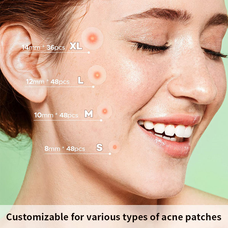 36pcs Custom Hydrocolloid Patch Blemish Pimple Sticker for Acne Spot Covers Household Application