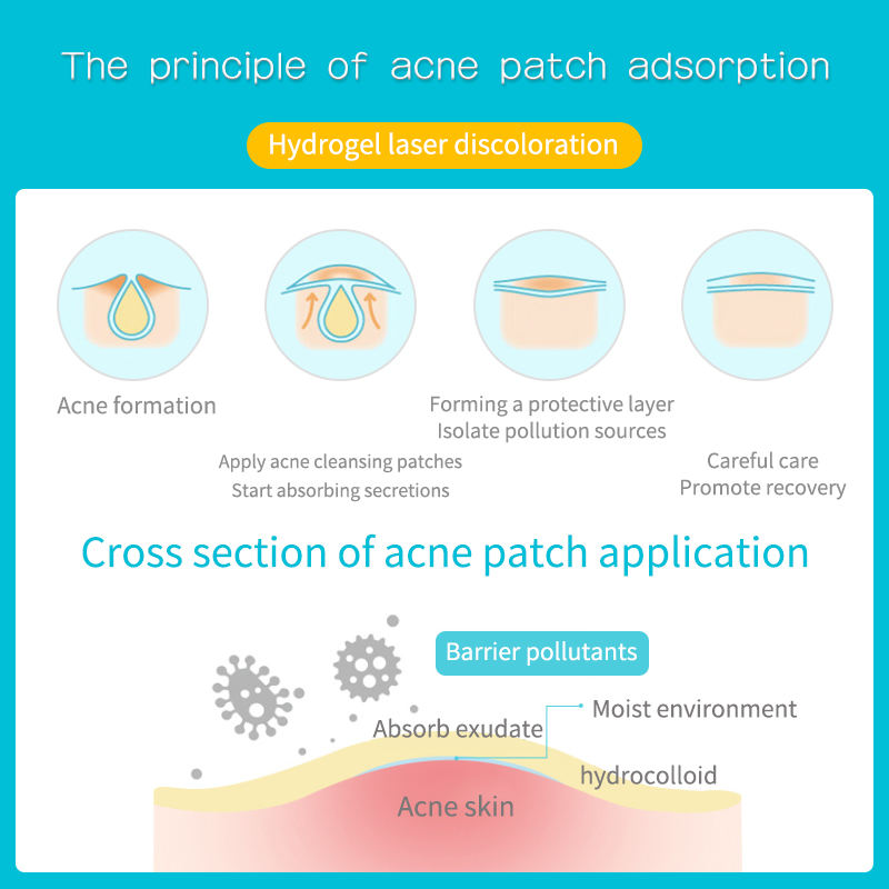 Cross-Border Special Supply of Color Laser Acne Patch for Makeup Fashion Love and Water Drop Shape Pimple Patch