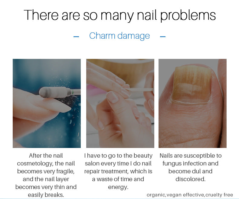 Wholesale Nail Repair Oil, Moisturizing Repair Serum, Smoothes Damaged Nail Beds, Nail Cracks and Hangnails 382