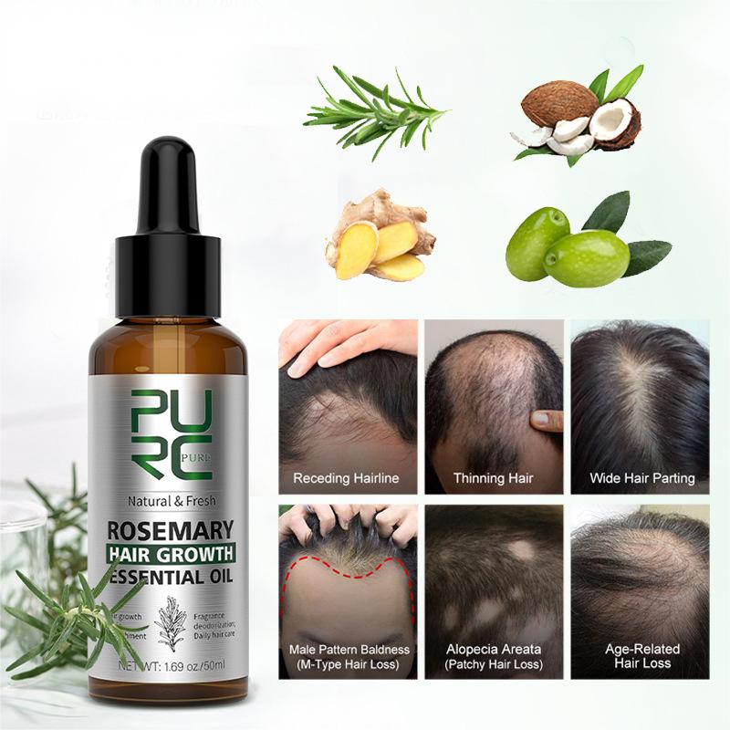 OEM & ODM Customized Rosemary Hair Care Essential oil, Mint and Ginger, Anti-Hair Loss Oiling 263