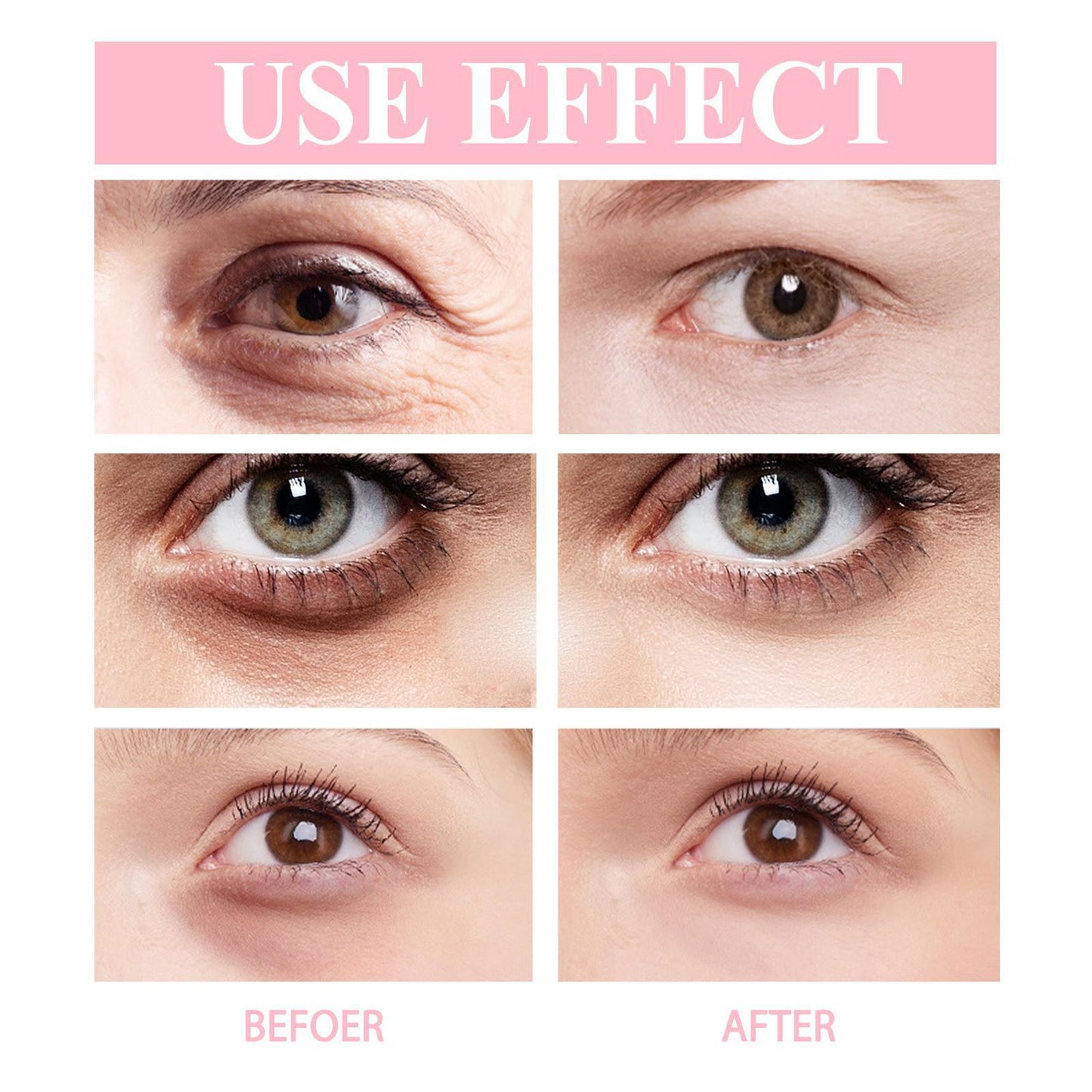 OEM Retinol Eye Cream Stick, Moisturizing and Tightening Eye Skin, Improving Fine Lines, Removing Dark Circles 406