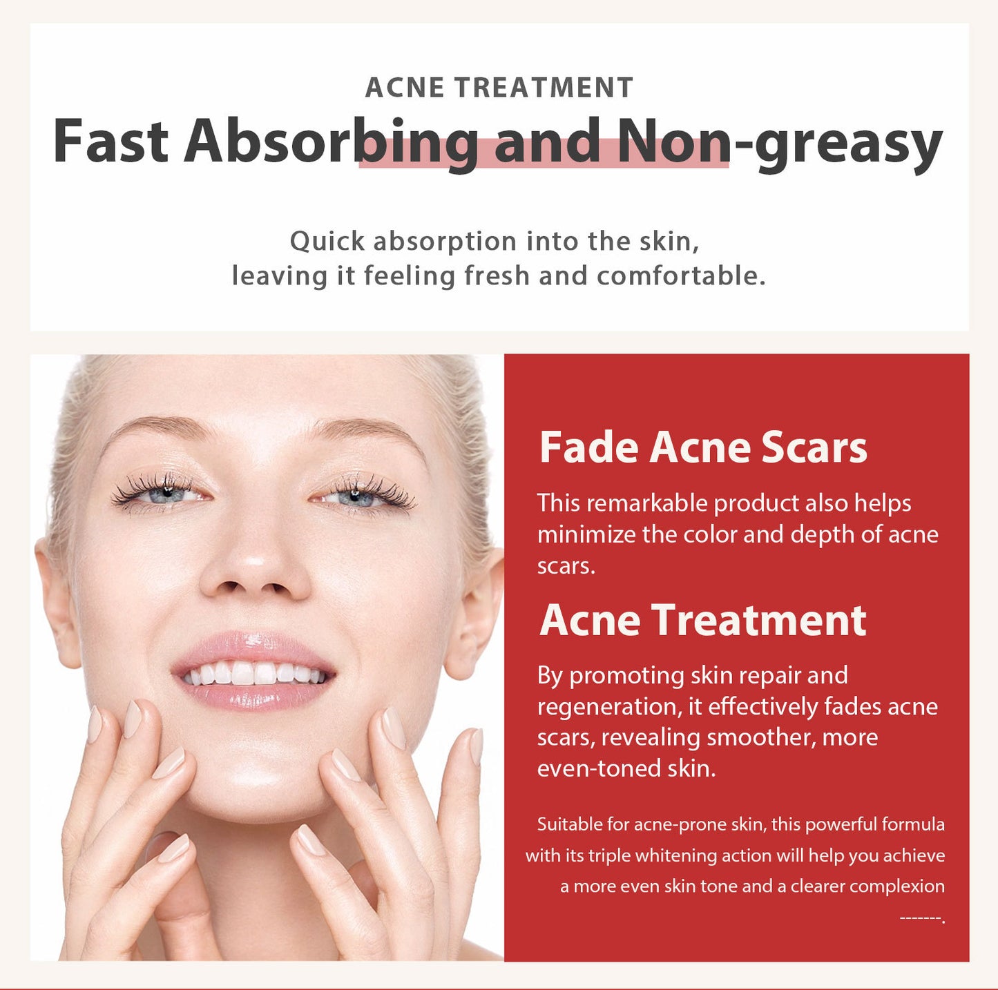 OEM Wholesale VC Anti-Acne, Niacinamide Anti-Spot Cream, Clean Pores, Facial Fade Cream 388