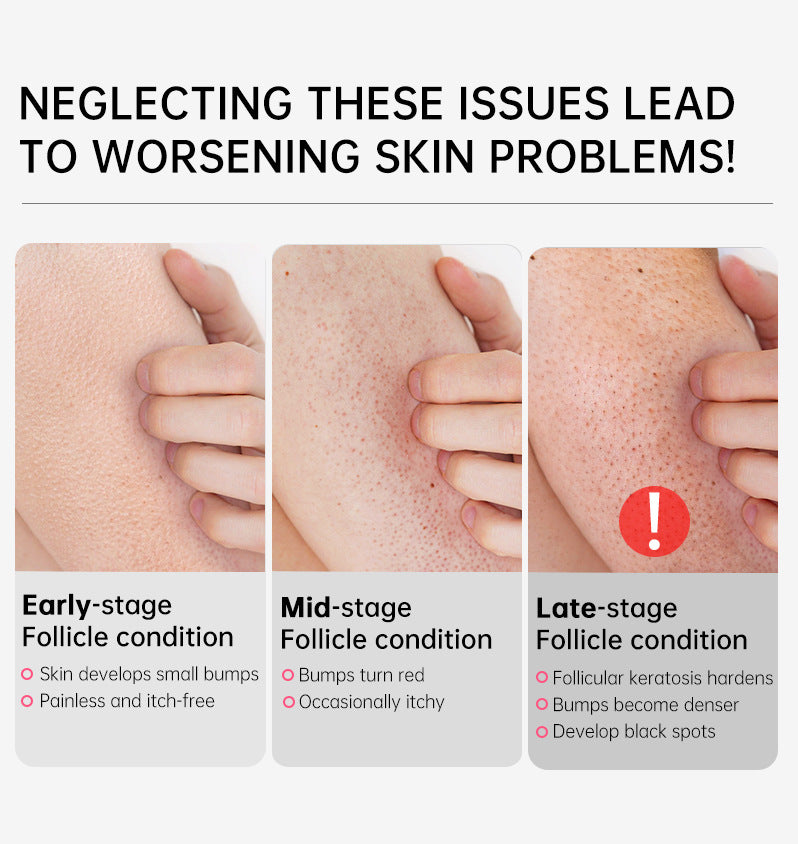 OEM & ODM Customized Body Repair Cream, Rough Skin Removal Cream, Moisturizing Skin 267