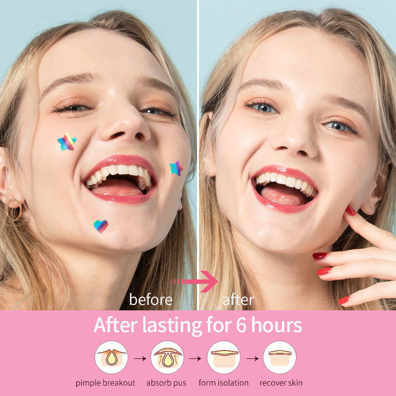 OEM Customizable Hydrocolloid Dots Patch for Acne and Spots Rainbow Antispot Healing Pimple Cover Face Spot Treatment